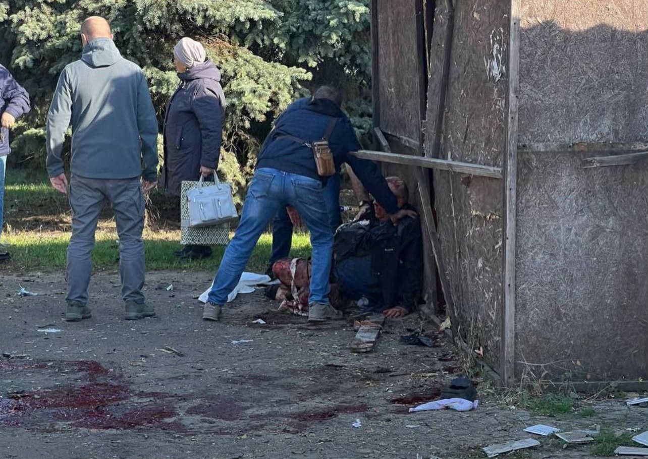Окупанти заявили, що в окупованому Луганську чоловікові відірвало ногу. Фото з телеграм