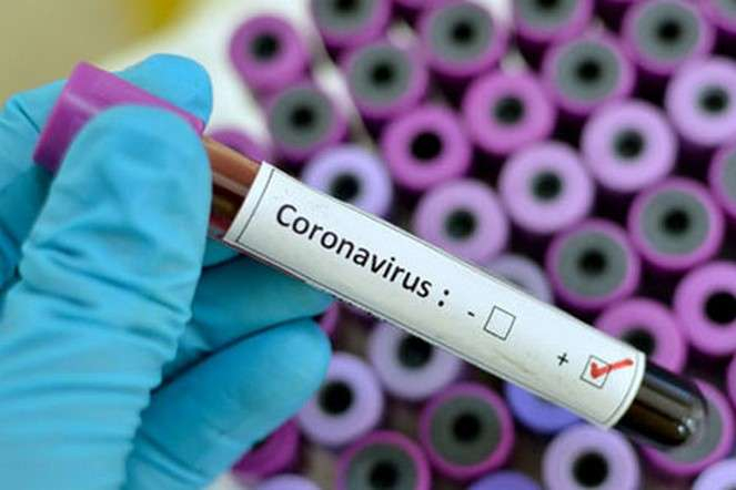 В Украине зарегистрировали первый смертельный случай от COVID-19