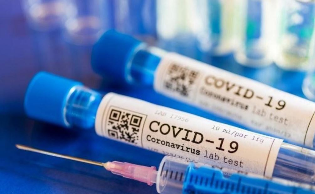 В Украине +876 случаев COVID-19 за сутки