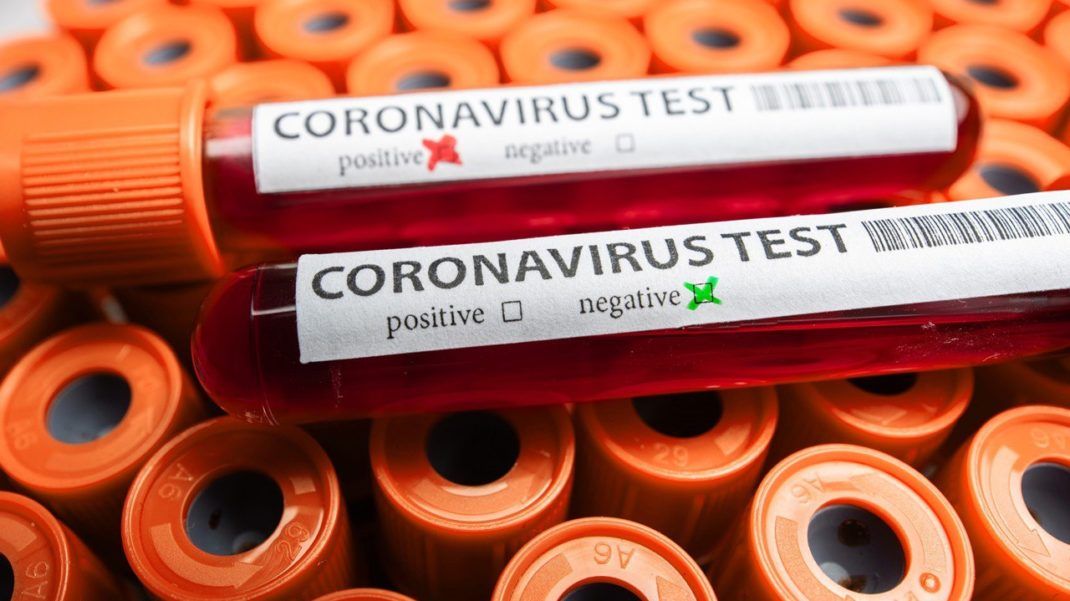 В Украине выявили 829 новых случаев COVID-19, за все время пандемии заболело 60 995 человек