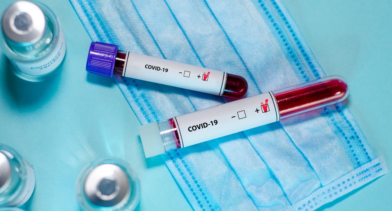 В Украине зафиксировано 1008 новых случаев COVID-19