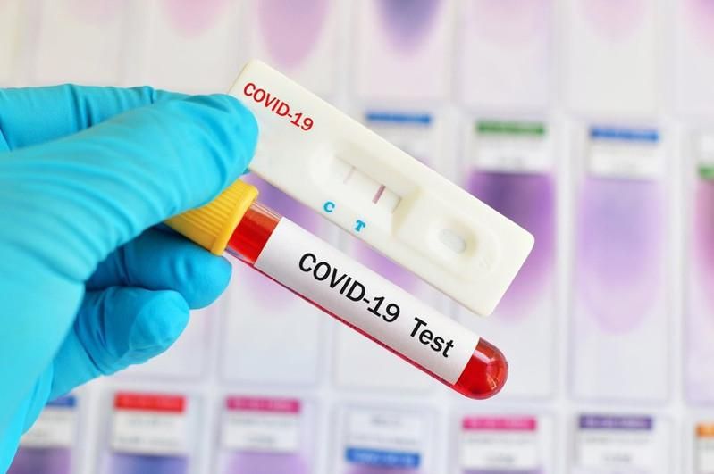 На Луганщине зафиксировано 6 новых случаев COVID-19