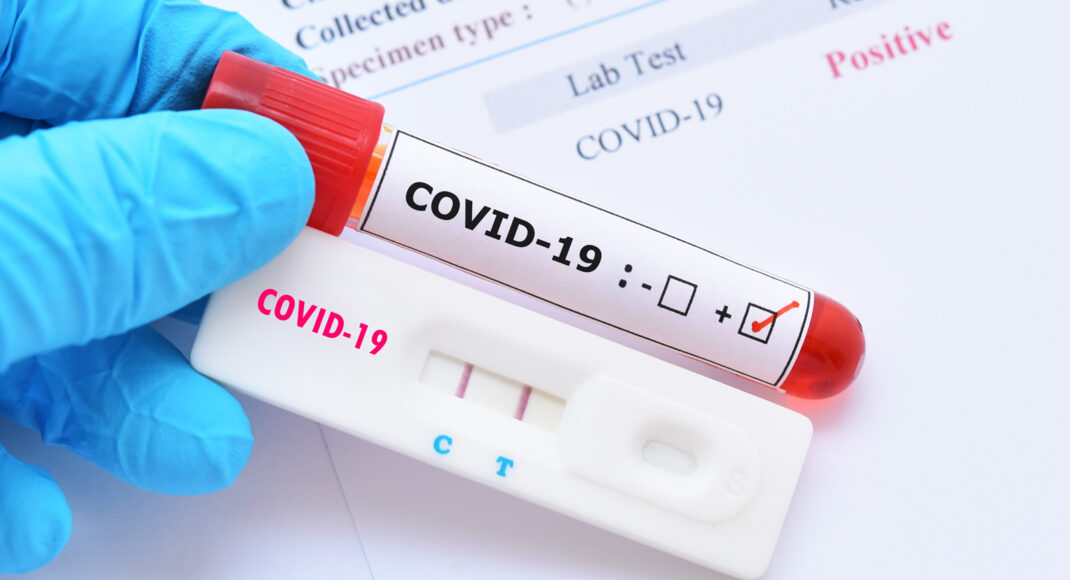 На Луганщине зафиксировали еще 19 случаев заражения COVID-19