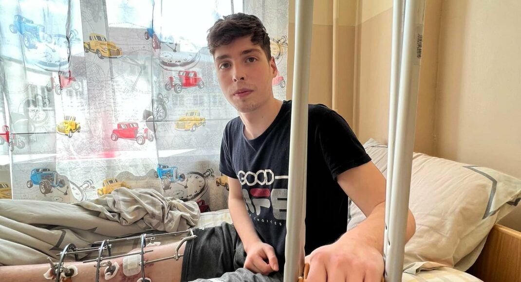 У Львові лікарі врятували ногу підлітку-волонтеру із Сєверодонецька (фото)
