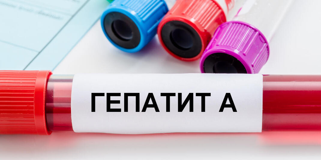 В Донецкой области за девять месяцев выявлено 13 случаев заболевания гепатитом A