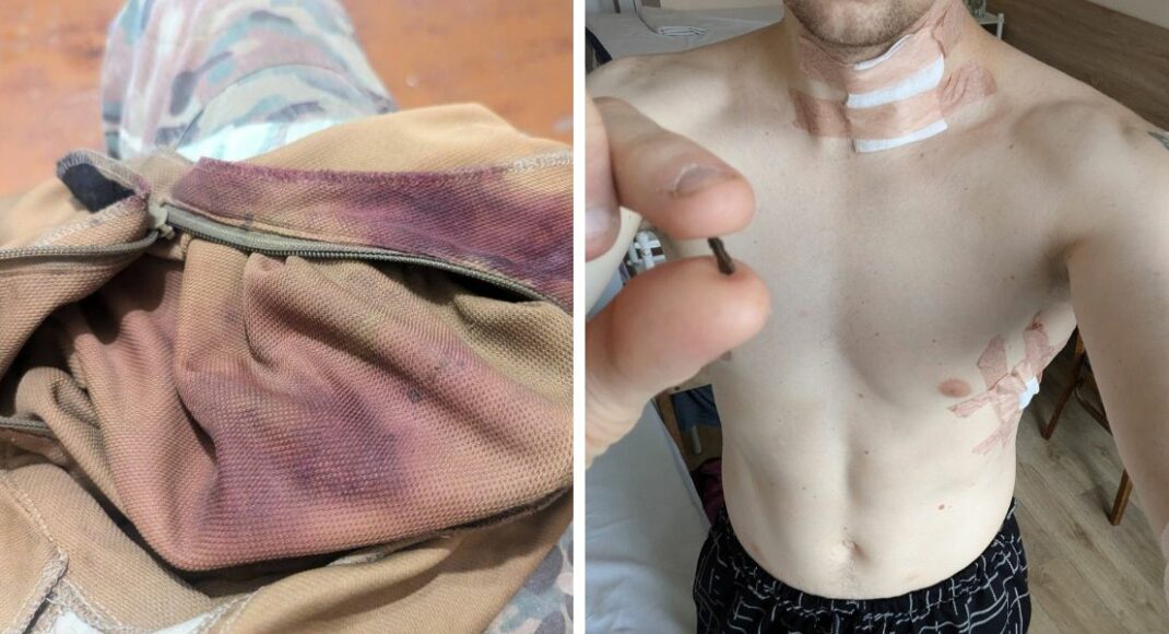 "Зі мною знову сталося диво": письменник і військовий Станіслав Асєєв розповів про наслідки свого поранення