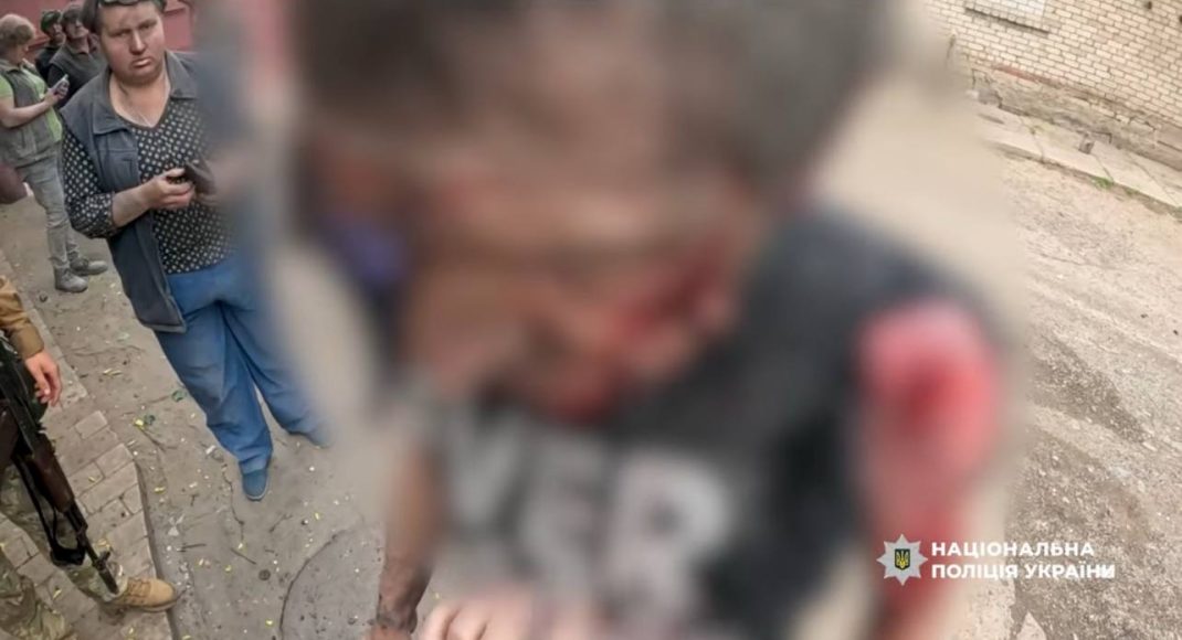 Парамедики полиции Дружковки спасают жизни людей под прицелом дронов (видео)